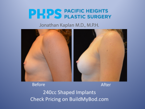 postop recovery after breast augmentation