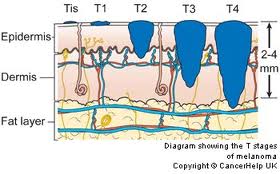 technique-shave-biopsy