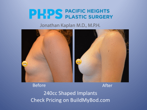 How to achieve a DD bra size with implants #plasticsurgery #plasticsur, Surgeon