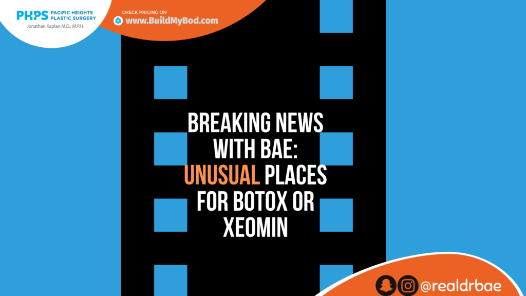 places to use botox or xeomin