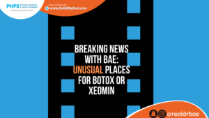 places to use botox or xeomin